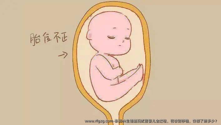 泰国ek生殖医院代孕全过程，初诊到移植，你都了解多少？