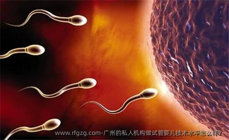 广州的私人机构做代孕技术水平怎么样？