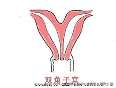 2025年泰国dhc代孕费用介绍
