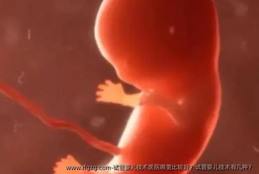 代孕技术医院哪里比较好？代孕技术有几种？