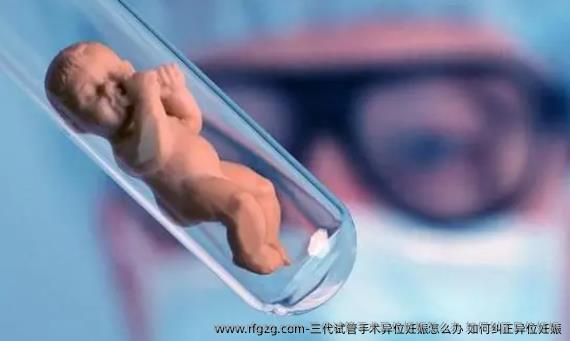 三代试管手术异位妊娠怎么办 如何纠正异位妊娠