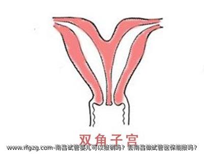 南昌代孕可以报销吗？去南昌做试管医保能报吗？